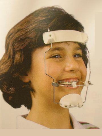 Le masque de delaire