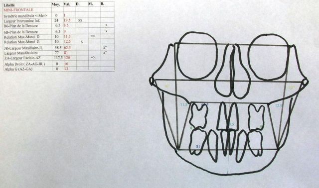 Etude de face des structures profondes